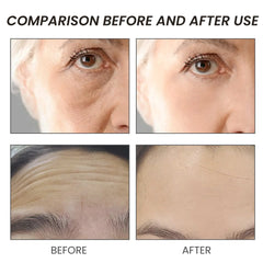 OUHOE Anti-Wrinkle Serum for Firming Skin